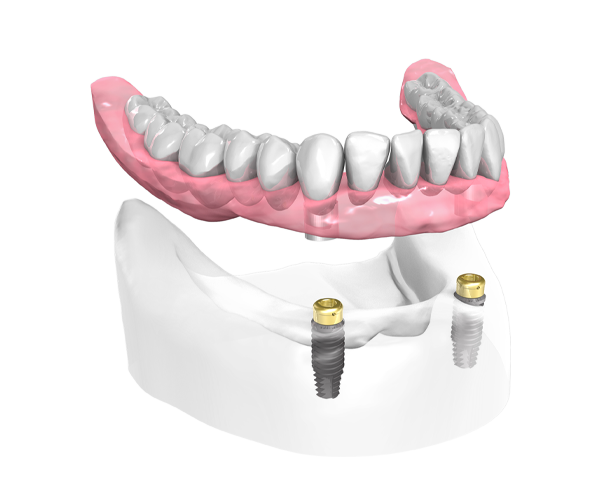 Dentiste Orsay